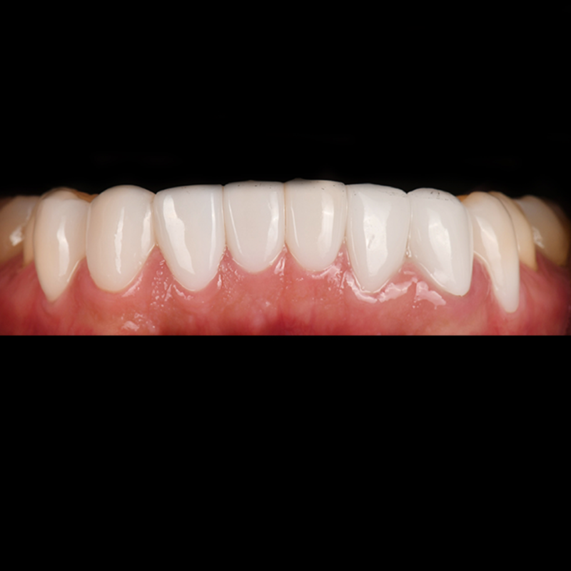 After