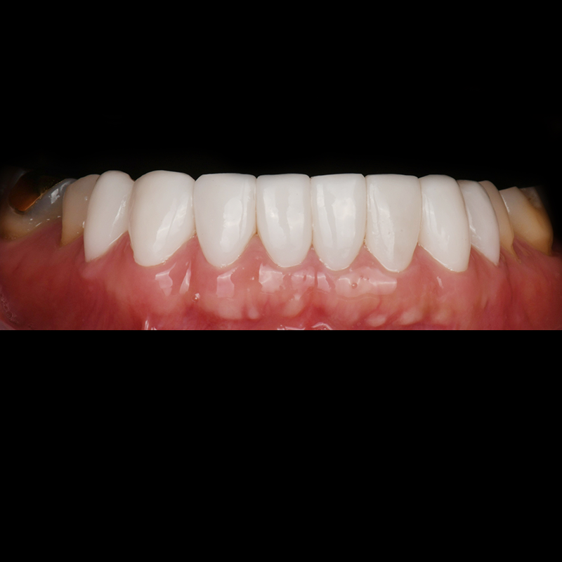 After