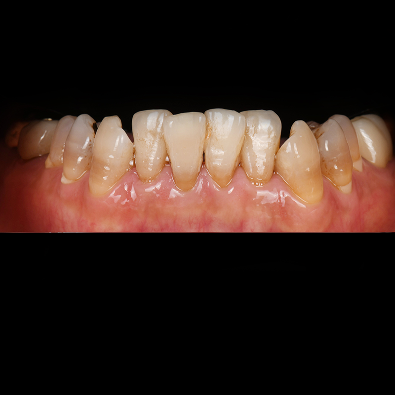 Before