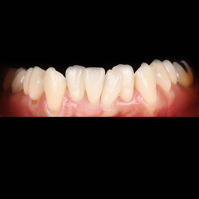 Before
