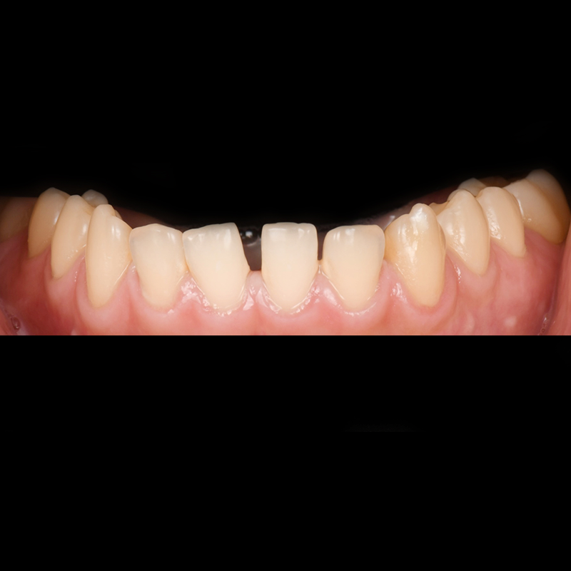 Before