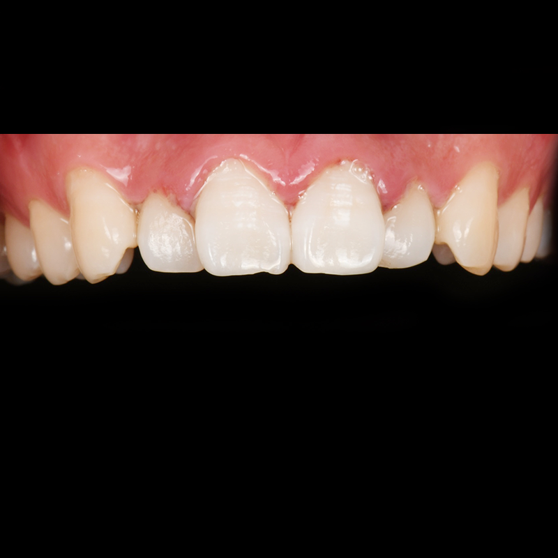 Before