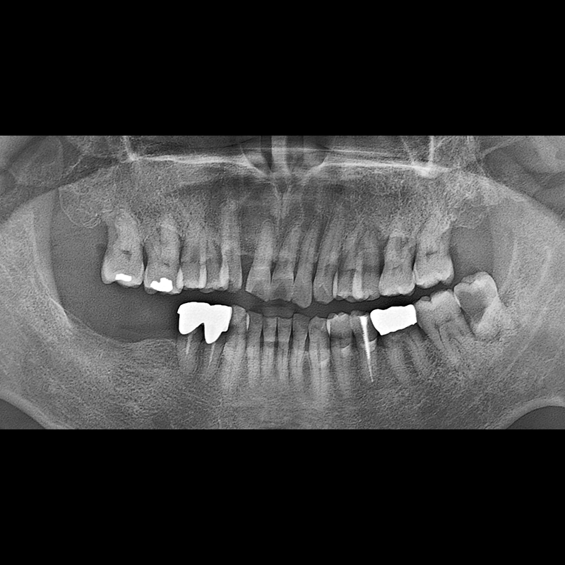 Before