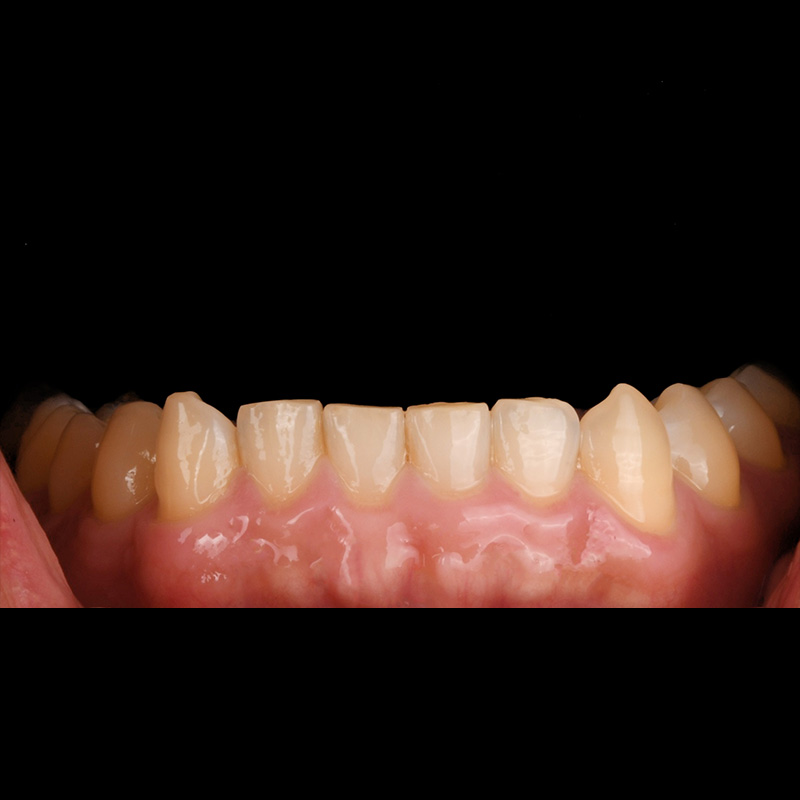 Before