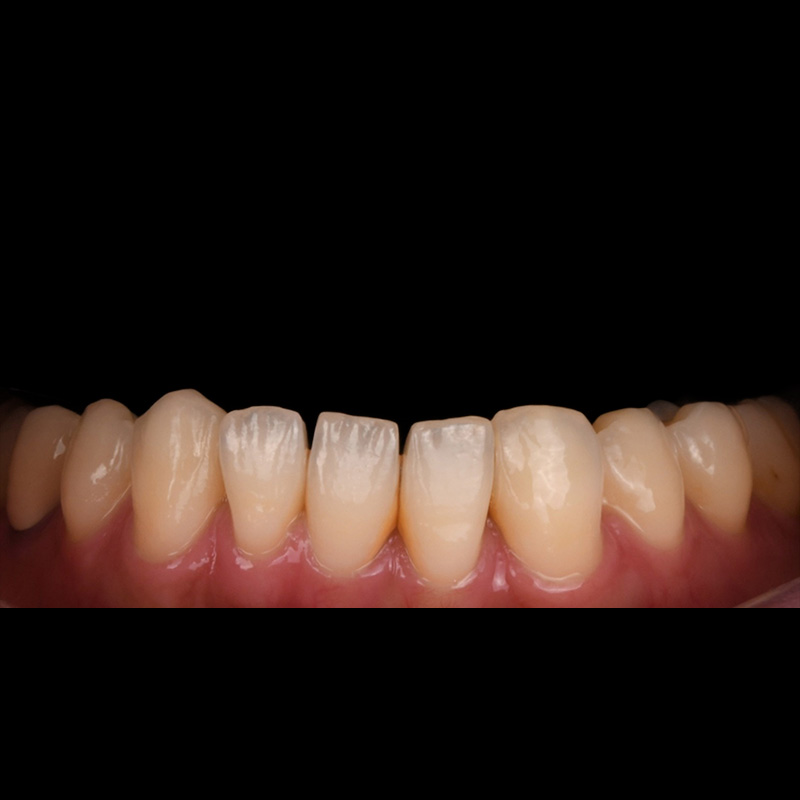 Before