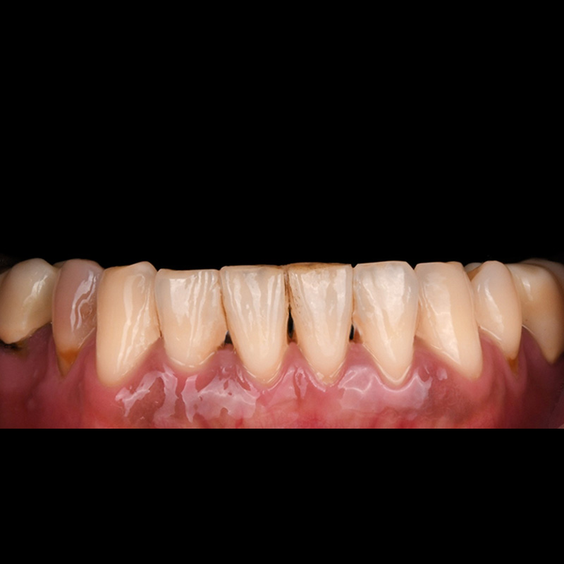 Before