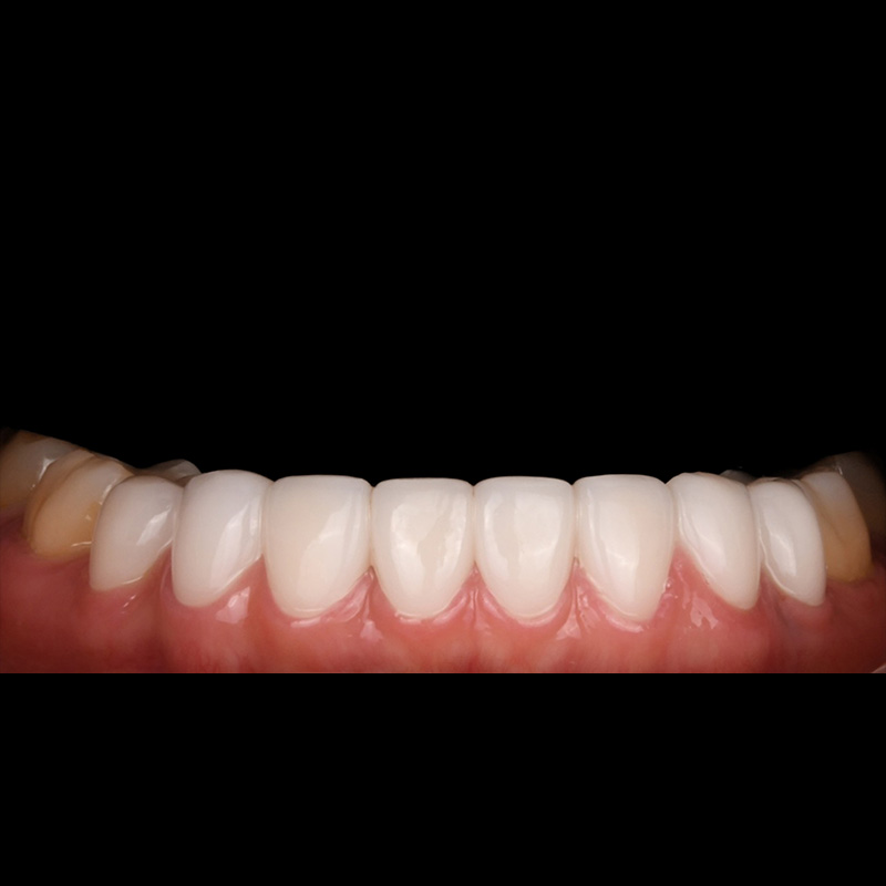 After