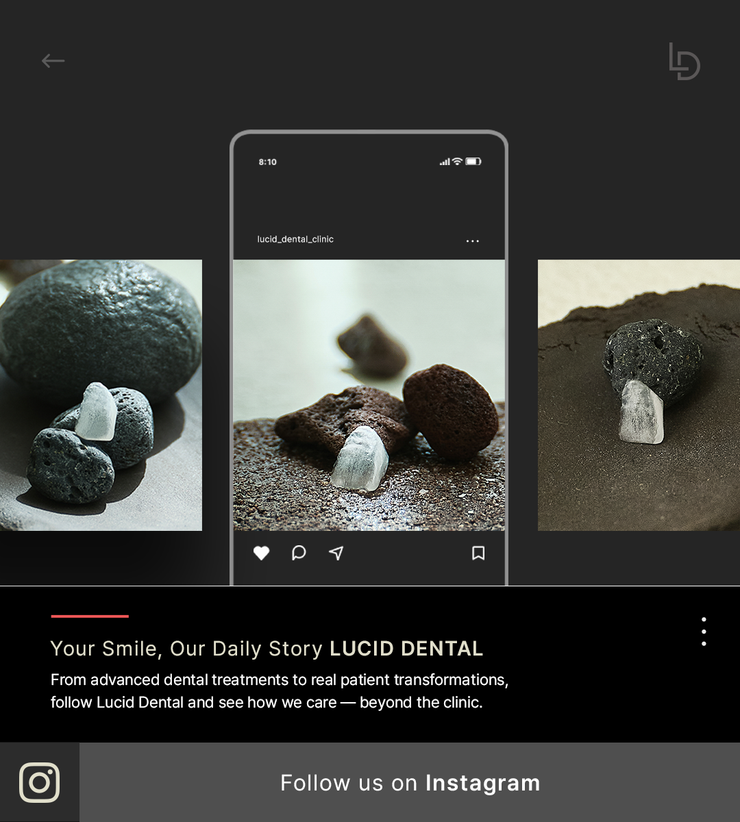 인스타그램_영문